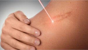 skin specialist in Wakad