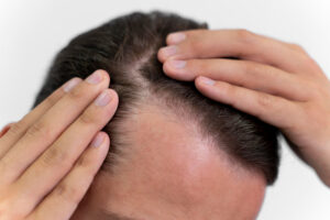 Hair Treatments in Wakad
