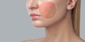 Best Dermatologist in Wakad