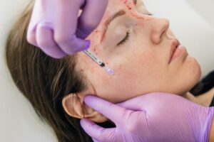 skin allergies Treatment in Wakad