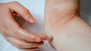 skin specialist in Wakad