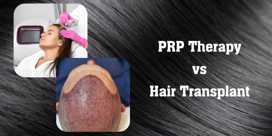 PRP Therapy vs Hair Transplant – Which Gives Better Results?