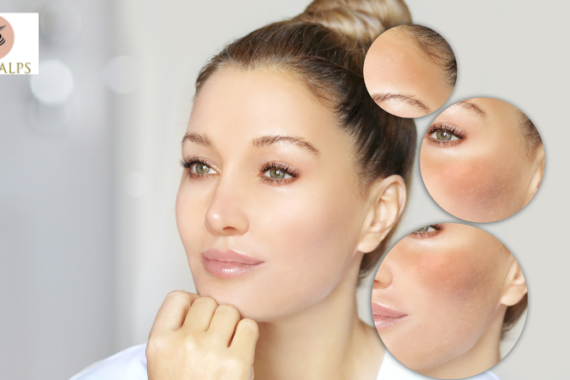 Skin Brightening Serum, Natural Beauty, Glowing Skin and Anti-Aging Guide – Best Skin Clinic in Wakad Pune