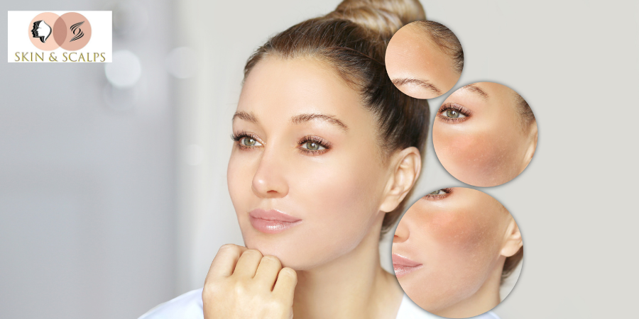 Skin Brightening Serum, Natural Beauty, Glowing Skin and Anti-Aging Guide – Best Skin Clinic in Wakad Pune