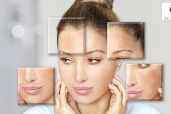 Skin Brightening Serum: Benefits, Ingredients, Uses, and How to Choose the Best One