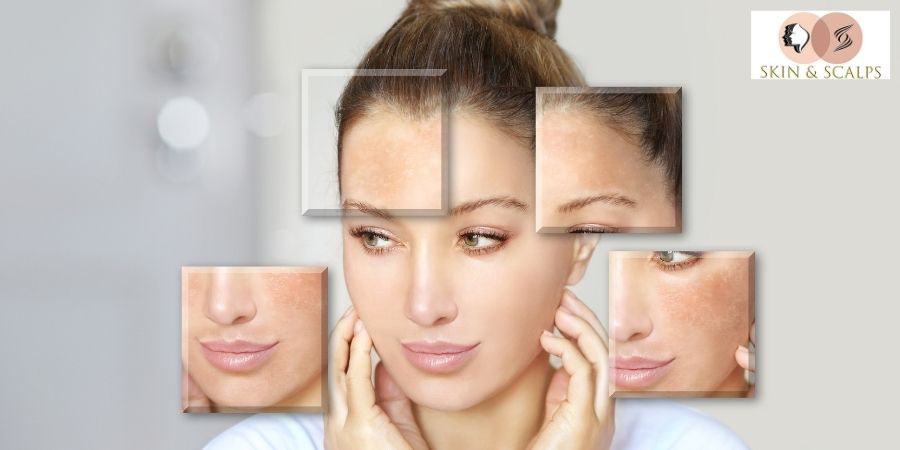 Skin Brightening Serum: Benefits, Ingredients, Uses, and How to Choose the Best One