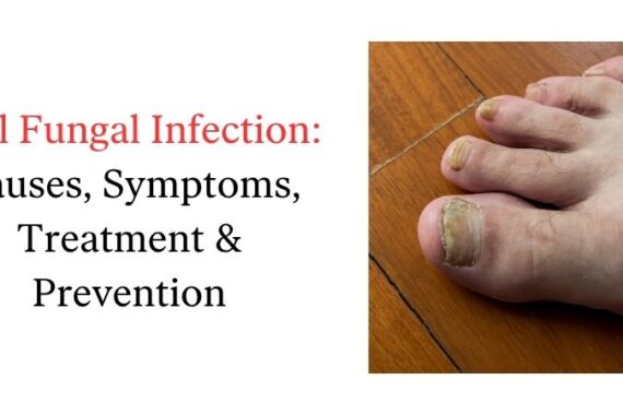 Nail Fungal Infection: Causes, Symptoms, Treatment & Prevention