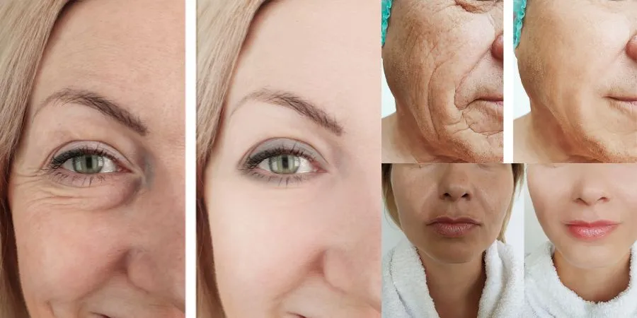 Proven Home Remedies to Reduce Wrinkles Naturally: What Works and What to Avoid